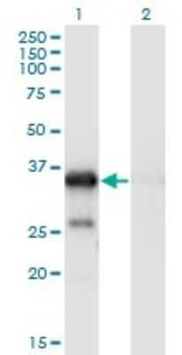 Western Blot: WBP2 Antibody (3B1) [H00023558-M02]