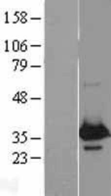 Western Blot: WBP2 Overexpression Lysate [NBL1-17781]