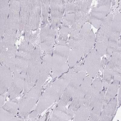 Immunohistochemistry-Paraffin: WBP2NL Antibody [NBP2-33531]