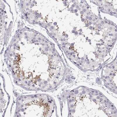 Immunohistochemistry-Paraffin: WBP2NL Antibody [NBP2-33531]