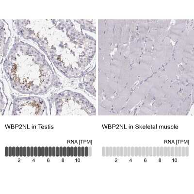 Immunohistochemistry-Paraffin: WBP2NL Antibody [NBP2-33531]