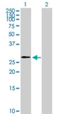 Western Blot: WBP2NL Antibody [H00164684-B01P]