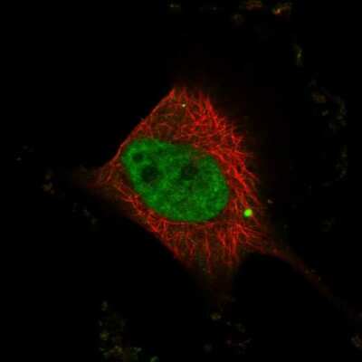 Immunocytochemistry/ Immunofluorescence: WBP4 Antibody [NBP1-84718]