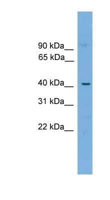 Western Blot: WBP4 Antibody [NBP1-79489]