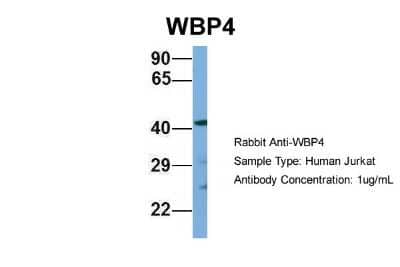 Western Blot: WBP4 Antibody [NBP1-79489]