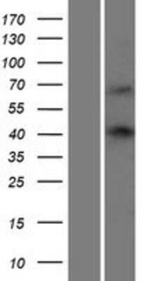 Western Blot: WBP4 Overexpression Lysate [NBP2-07519]