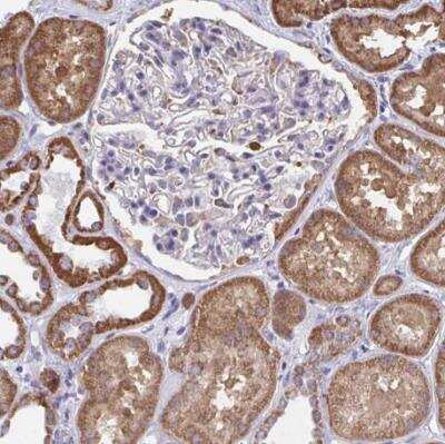 Immunohistochemistry-Paraffin: WBSCR16 Antibody [NBP2-31833]