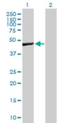 Western Blot: WBSCR16 Antibody [H00081554-B01P]