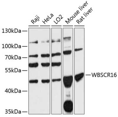 Western Blot: WBSCR16 AntibodyAzide and BSA Free [NBP2-93276]