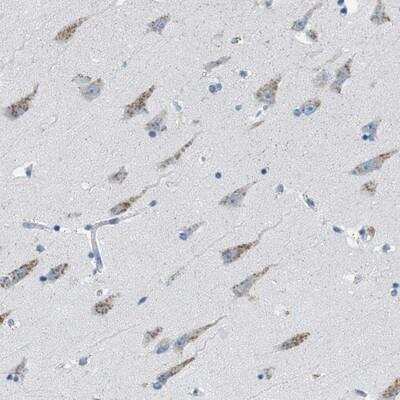 Immunohistochemistry-Paraffin: WBSCR17 Antibody [NBP1-81843]