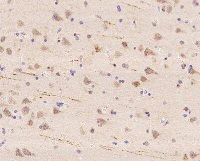 Immunohistochemistry-Paraffin: WBSCR17 Antibody [NBP3-12659]