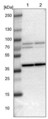 Western Blot: WBSCR17 Antibody [NBP1-81843]