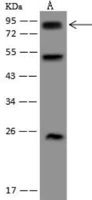 Western Blot: WBSCR17 Antibody [NBP3-12659]