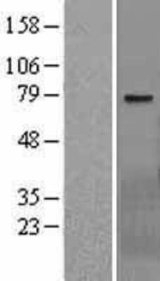 Western Blot: WBSCR17 Overexpression Lysate [NBL1-17784]