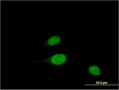 Immunocytochemistry/ Immunofluorescence: WBSCR22 Antibody (2E12) [H00114049-M11]