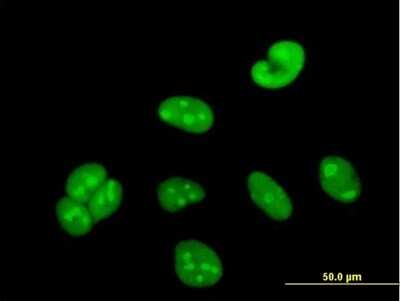 Immunocytochemistry/ Immunofluorescence: WBSCR22 Antibody [H00114049-B01P]