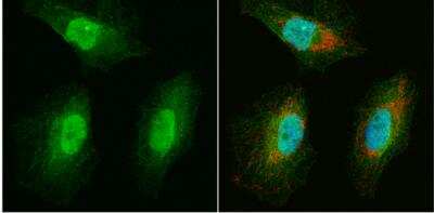 Immunocytochemistry/ Immunofluorescence: WBSCR22 Antibody [NBP1-31454]