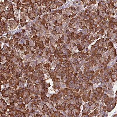Immunohistochemistry-Paraffin: WBSCR22 Antibody [NBP2-13520]