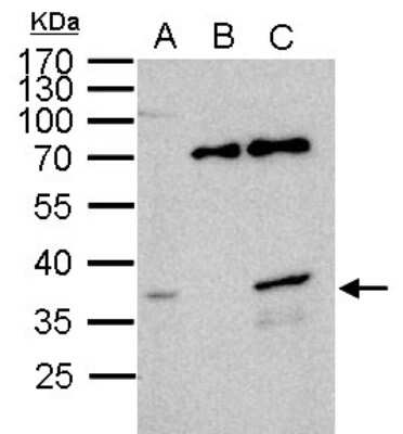 Western Blot: WBSCR22 Antibody [NBP1-31454]