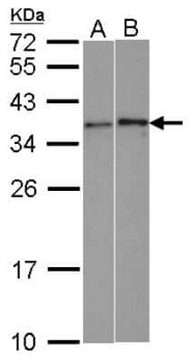 Western Blot: WBSCR22 Antibody [NBP1-31454]