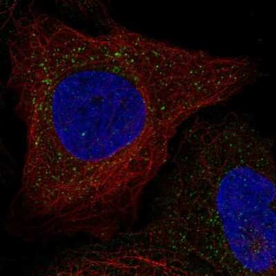 Immunocytochemistry/ Immunofluorescence: WBSCR28 Antibody [NBP2-69031]