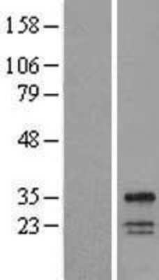 Western Blot: WBSCR28 Overexpression Lysate [NBL1-17787]