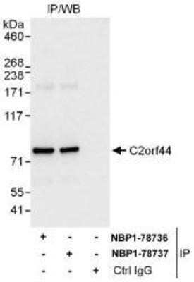 Immunoprecipitation: WDCP Antibody [NBP1-78736]