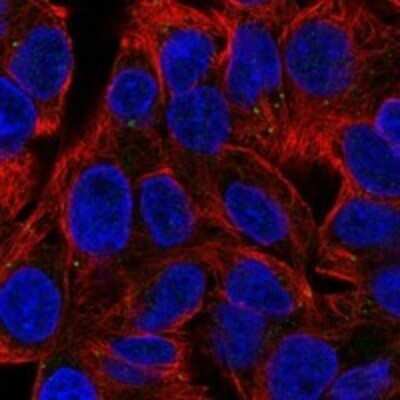 Immunocytochemistry/ Immunofluorescence: WDFY2 Antibody [NBP3-17455]