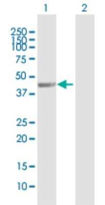 Western Blot: WDFY2 Antibody [H00115825-B01P]