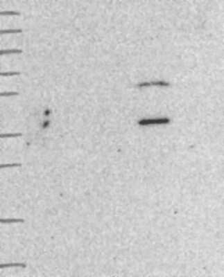 Western Blot: WDFY2 Antibody [NBP3-17455]