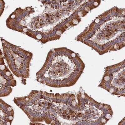 Immunohistochemistry-Paraffin: WDFY3 Antibody [NBP2-48910]