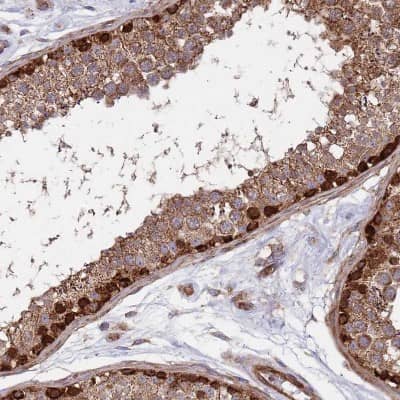 Immunohistochemistry-Paraffin: WDFY3 Antibody [NBP2-48910]