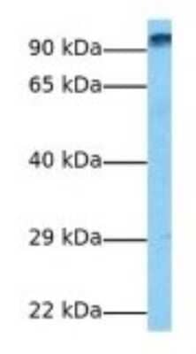 Western Blot: WDFY3 Antibody [NBP3-09287]