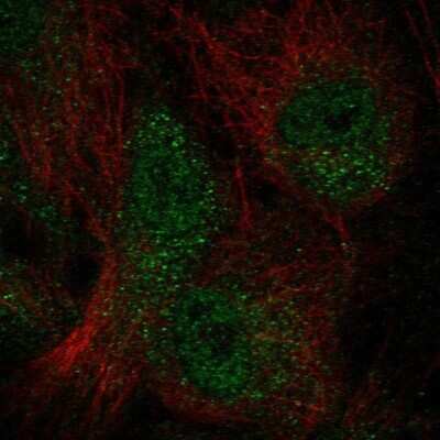 Immunocytochemistry/ Immunofluorescence: WDFY4 Antibody [NBP1-90743]