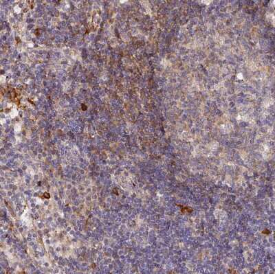 Immunohistochemistry-Paraffin: WDFY4 Antibody [NBP1-90743]