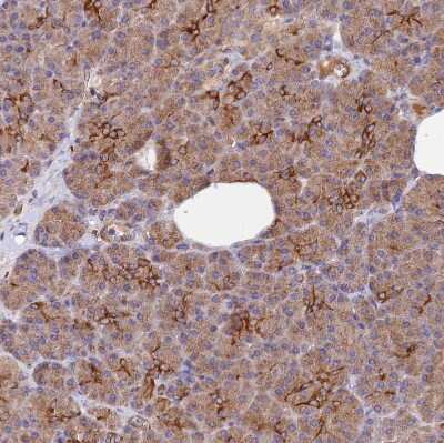 Immunohistochemistry-Paraffin: WDFY4 Antibody [NBP1-90743]