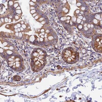 Immunohistochemistry-Paraffin: WDFY4 Antibody [NBP1-90743]