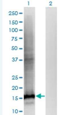 Western Blot: WDHD1 Antibody (2F10) [H00011169-M01-100ug]