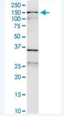 Western Blot: WDHD1 Antibody (2F10) [H00011169-M01-100ug]