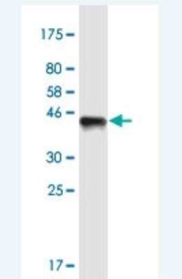 Western Blot: WDHD1 Antibody (2F10) [H00011169-M01-100ug]