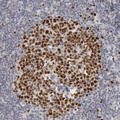 Immunohistochemistry-Paraffin: WDHD1 Antibody [NBP1-89091]