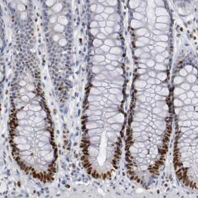 Immunohistochemistry-Paraffin: WDHD1 Antibody [NBP1-89091]