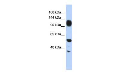 Western Blot: WDHD1 Antibody [NBP2-86064]