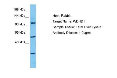 Western Blot: WDHD1 Antibody [NBP2-86067]