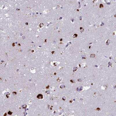 Immunohistochemistry-Paraffin: WDPCP Antibody [NBP1-92580]