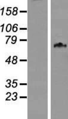 Western Blot: WDPCP Overexpression Lysate [NBL1-12614]