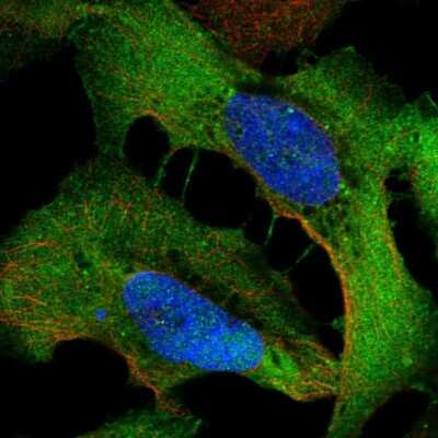 Immunocytochemistry/ Immunofluorescence: WDR1 Antibody [NBP2-68898]