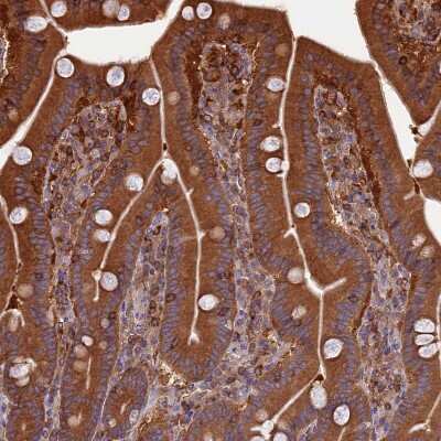 Immunohistochemistry-Paraffin: WDR1 Antibody [NBP2-32665]
