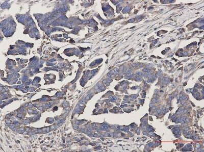 Immunohistochemistry-Paraffin: WDR1 Antibody (S01-6D6) [NBP3-19802]