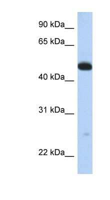 Western Blot: WDR1 Antibody [NBP1-54754]